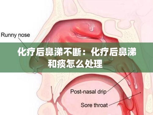 化疗后鼻涕不断：化疗后鼻涕和痰怎么处理 